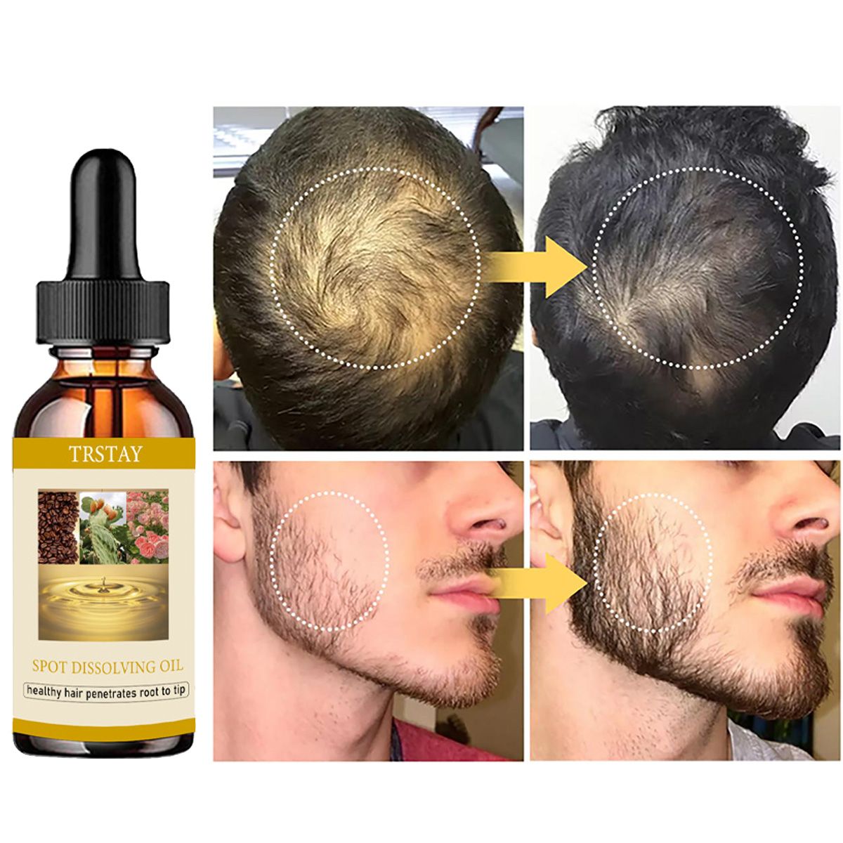 50ML Beard Growth Oil Anti Alo - Beard Oil recension och pris